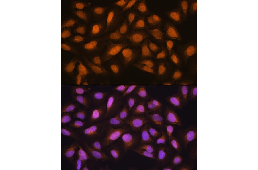 Immunofluorescence - Anti-SKP2 Antibody (A15857) - Antibodies.com