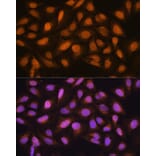 Immunofluorescence - Anti-SKP2 Antibody (A15857) - Antibodies.com