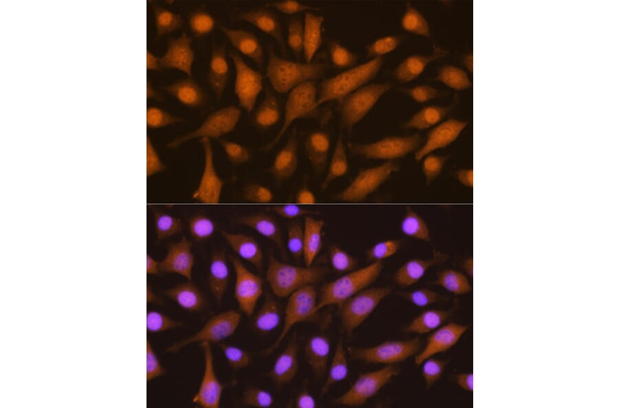 Immunofluorescence - Anti-SKP2 Antibody (A15857) - Antibodies.com