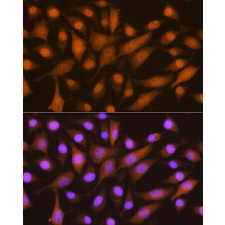 Immunofluorescence - Anti-SKP2 Antibody (A15857) - Antibodies.com