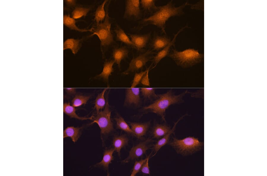 Immunofluorescence - Anti-SKP2 Antibody (A15857) - Antibodies.com