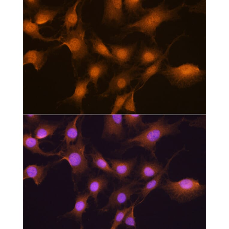 Immunofluorescence - Anti-SKP2 Antibody (A15857) - Antibodies.com