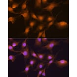 Immunofluorescence - Anti-SKP2 Antibody (A15857) - Antibodies.com