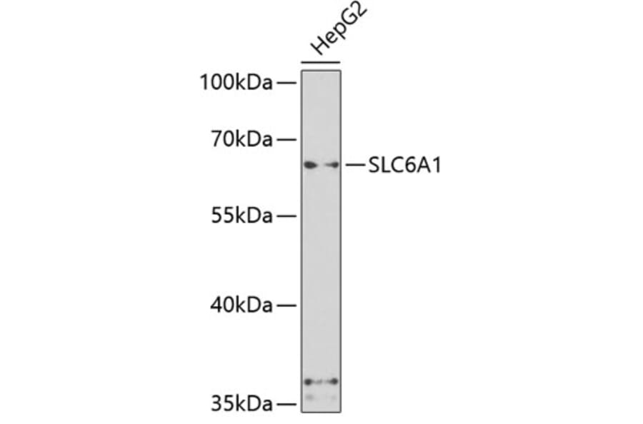 Western Blot - Anti-SLC6A1 Antibody (A7730) - Antibodies.com