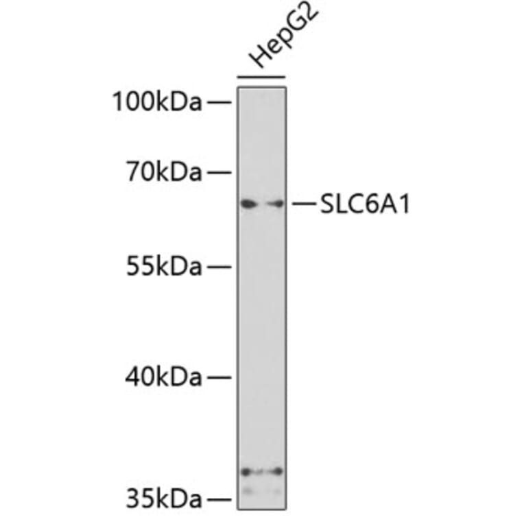 Western Blot - Anti-SLC6A1 Antibody (A7730) - Antibodies.com
