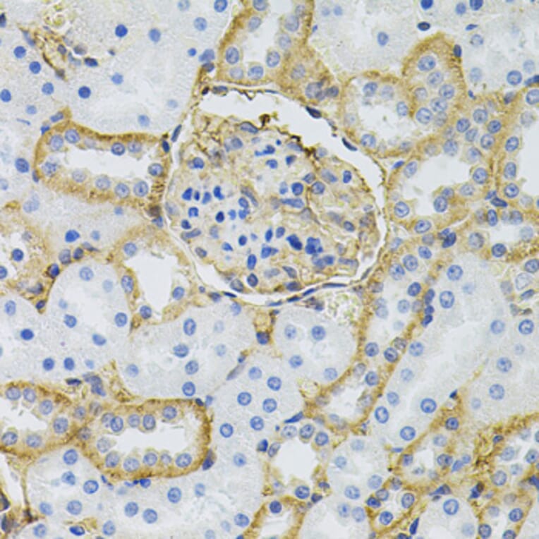 Immunohistochemistry - Anti-SLC6A1 Antibody (A7730) - Antibodies.com