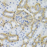 Immunohistochemistry - Anti-SLC6A1 Antibody (A7730) - Antibodies.com