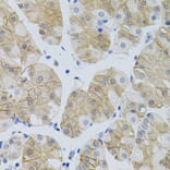 Immunohistochemistry - Anti-SLC6A1 Antibody (A7730) - Antibodies.com