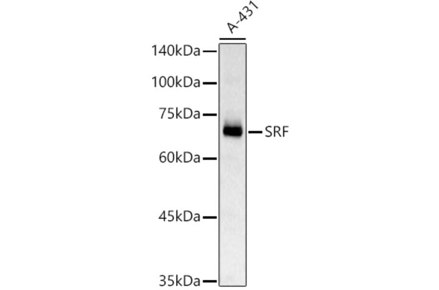 Western Blot - Anti-Serum Response Factor SRF Antibody (A15859) - Antibodies.com