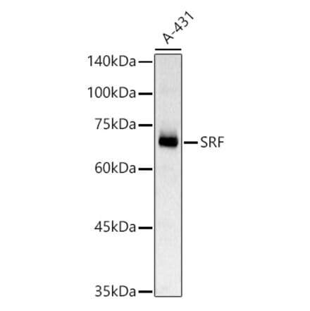 Western Blot - Anti-Serum Response Factor SRF Antibody (A15859) - Antibodies.com