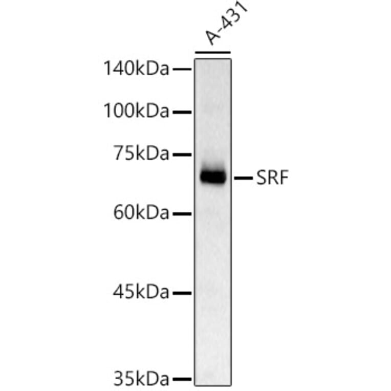 Western Blot - Anti-Serum Response Factor SRF Antibody (A15859) - Antibodies.com