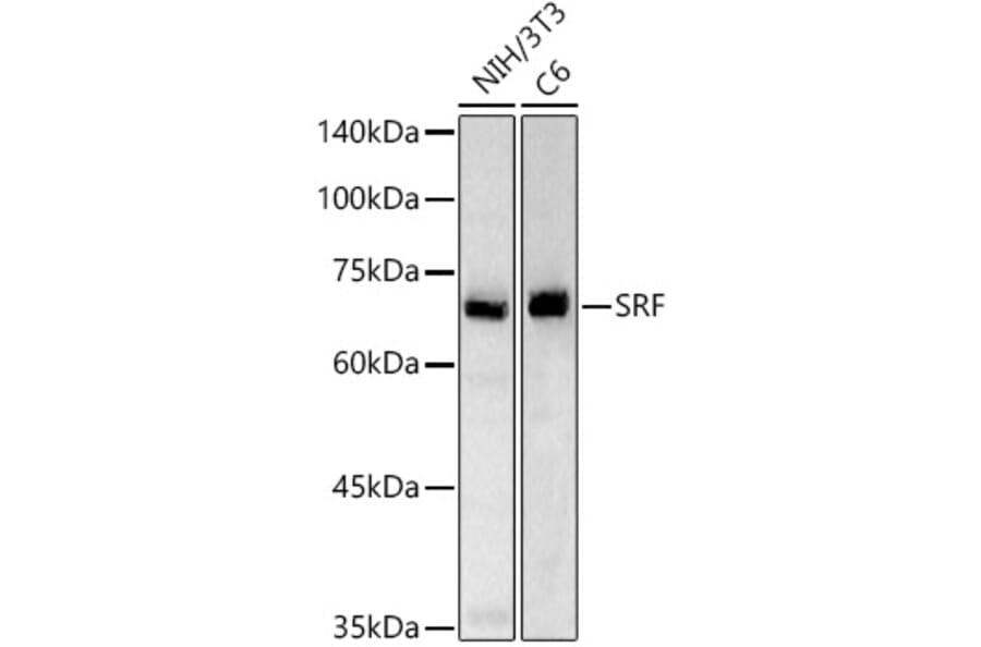 Western Blot - Anti-Serum Response Factor SRF Antibody (A15859) - Antibodies.com