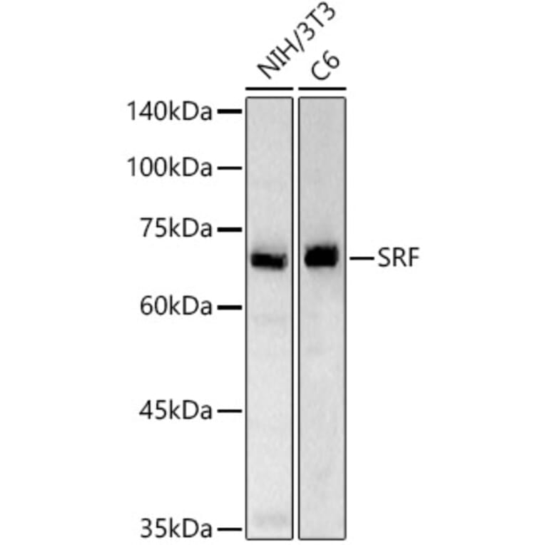 Western Blot - Anti-Serum Response Factor SRF Antibody (A15859) - Antibodies.com