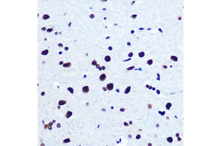 Immunohistochemistry - Anti-Serum Response Factor SRF Antibody (A15859) - Antibodies.com