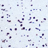 Immunohistochemistry - Anti-Serum Response Factor SRF Antibody (A15859) - Antibodies.com