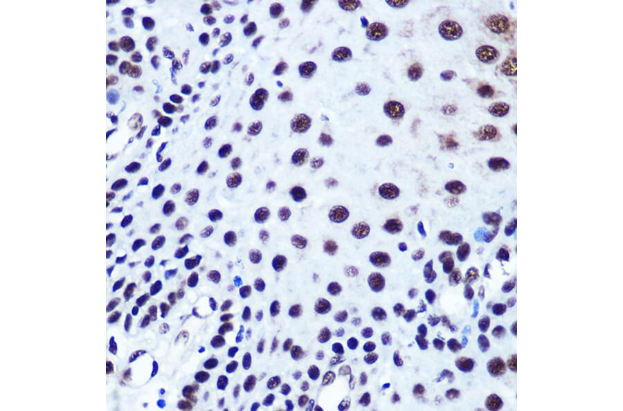 Immunohistochemistry - Anti-Serum Response Factor SRF Antibody (A15859) - Antibodies.com