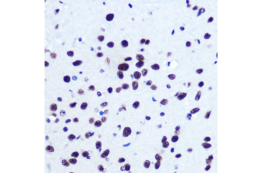 Immunohistochemistry - Anti-Serum Response Factor SRF Antibody (A15859) - Antibodies.com