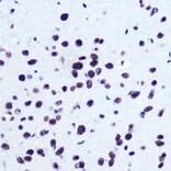 Immunohistochemistry - Anti-Serum Response Factor SRF Antibody (A15859) - Antibodies.com