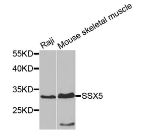 Western Blot - Anti-SSX5 Antibody (A7732) - Antibodies.com