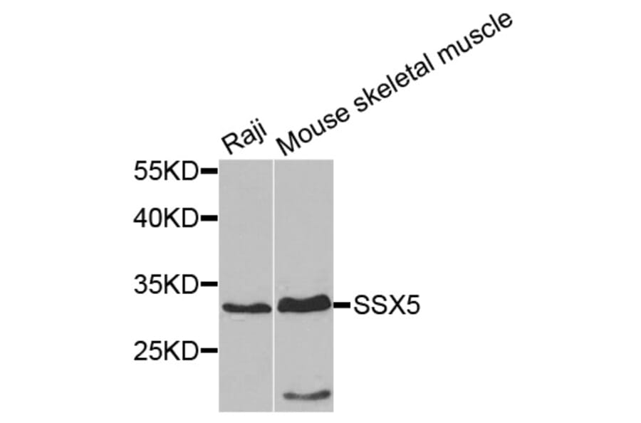 Western Blot - Anti-SSX5 Antibody (A7732) - Antibodies.com