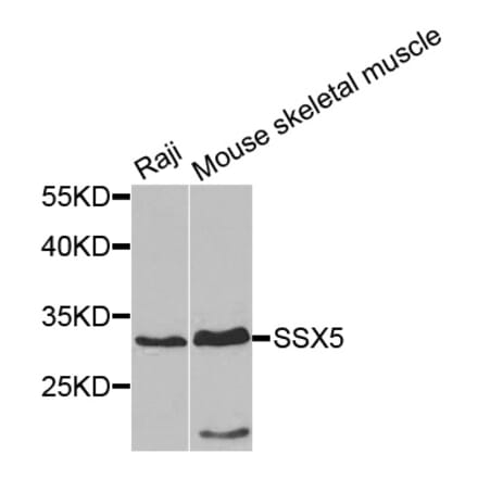 Western Blot - Anti-SSX5 Antibody (A7732) - Antibodies.com