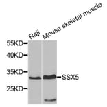 Western Blot - Anti-SSX5 Antibody (A7732) - Antibodies.com