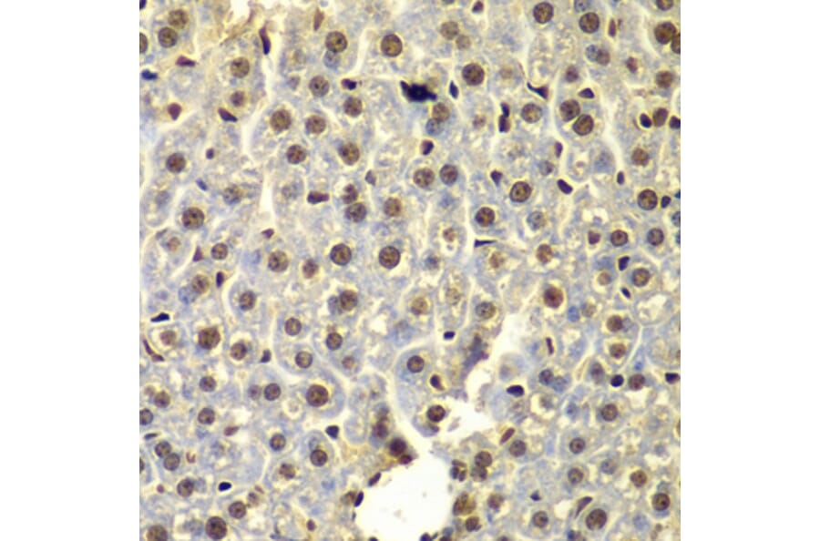 Immunohistochemistry - Anti-SSX5 Antibody (A7732) - Antibodies.com