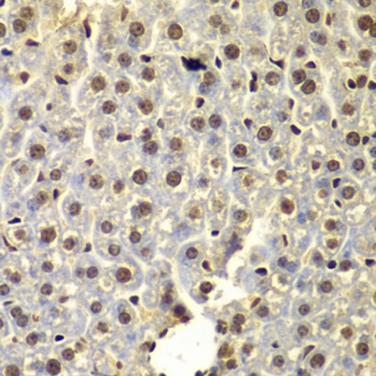 Immunohistochemistry - Anti-SSX5 Antibody (A7732) - Antibodies.com