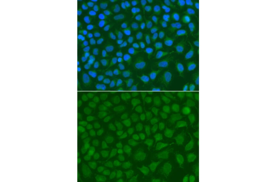 Immunofluorescence - Anti-SSX5 Antibody (A7732) - Antibodies.com