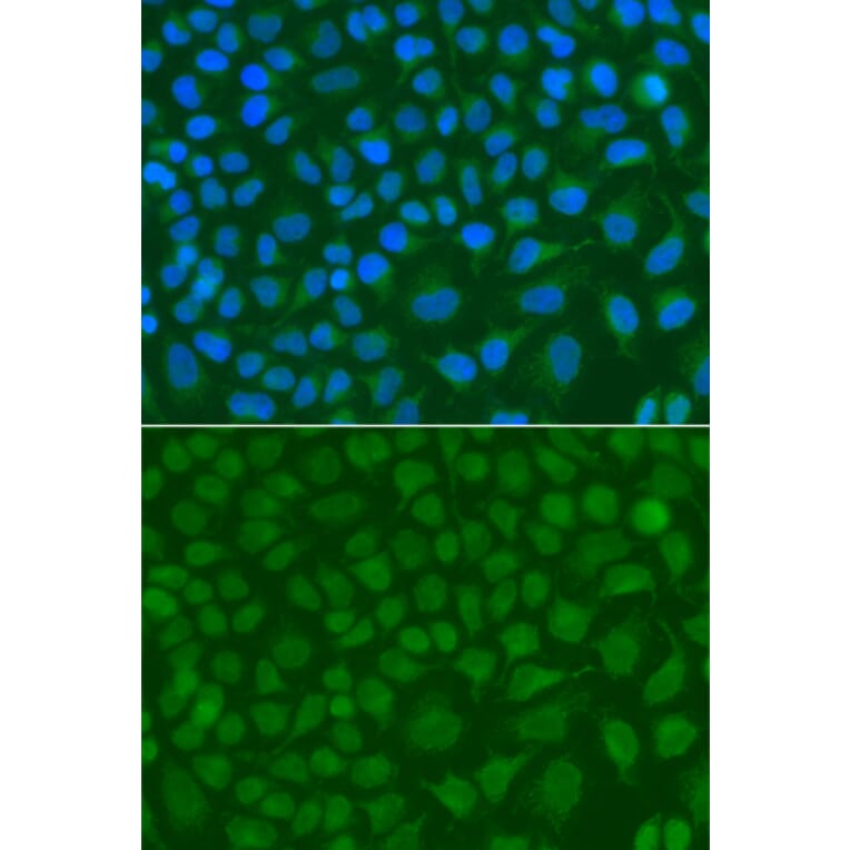 Immunofluorescence - Anti-SSX5 Antibody (A7732) - Antibodies.com