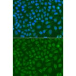 Immunofluorescence - Anti-SSX5 Antibody (A7732) - Antibodies.com