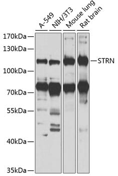 Western blot analysis of extracts of various cell lines, using Anti-STRN Antibody (A7734) at 1:1,000 dilution.
Secondary antibody: Goat Anti-Rabbit IgG (H+L) (HRP) (AS014) at 1:10,000 dilution.
Lysates / proteins: 25µg per lane.
Blocking buffer: 3% non-fat dry milk in TBST.
Detection: ECL Basic Kit (RM00020).
Exposure time: 90s.