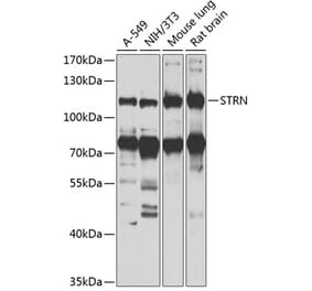 Western Blot - Anti-Striatin Antibody (A15861) - Antibodies.com
