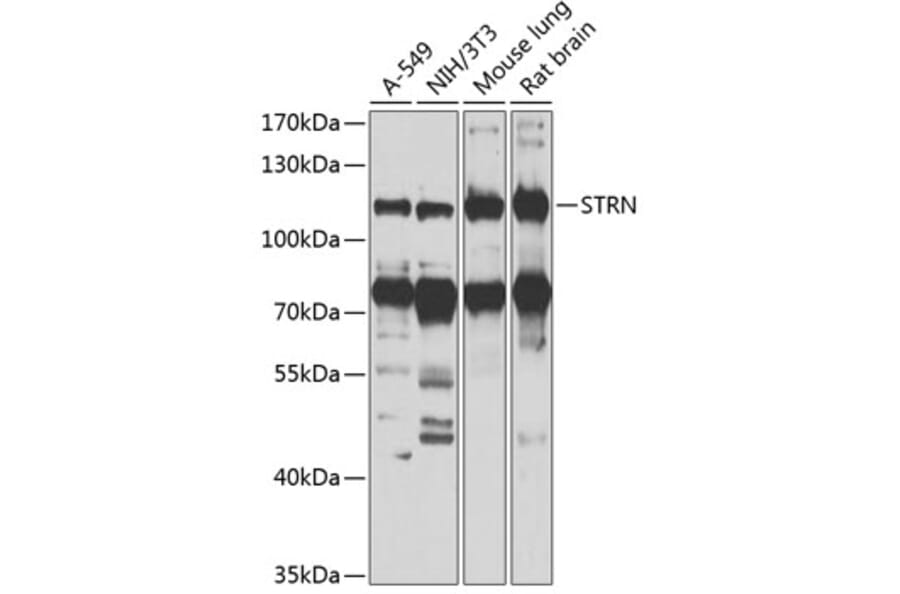 Western Blot - Anti-Striatin Antibody (A15861) - Antibodies.com