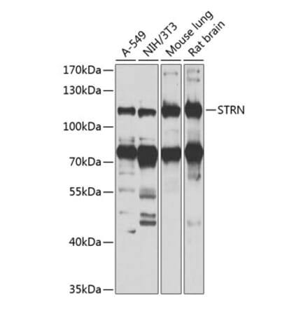 Western Blot - Anti-Striatin Antibody (A15861) - Antibodies.com