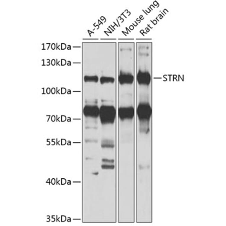 Western Blot - Anti-Striatin Antibody (A15861) - Antibodies.com