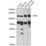 Western Blot - Anti-Striatin Antibody (A15861) - Antibodies.com