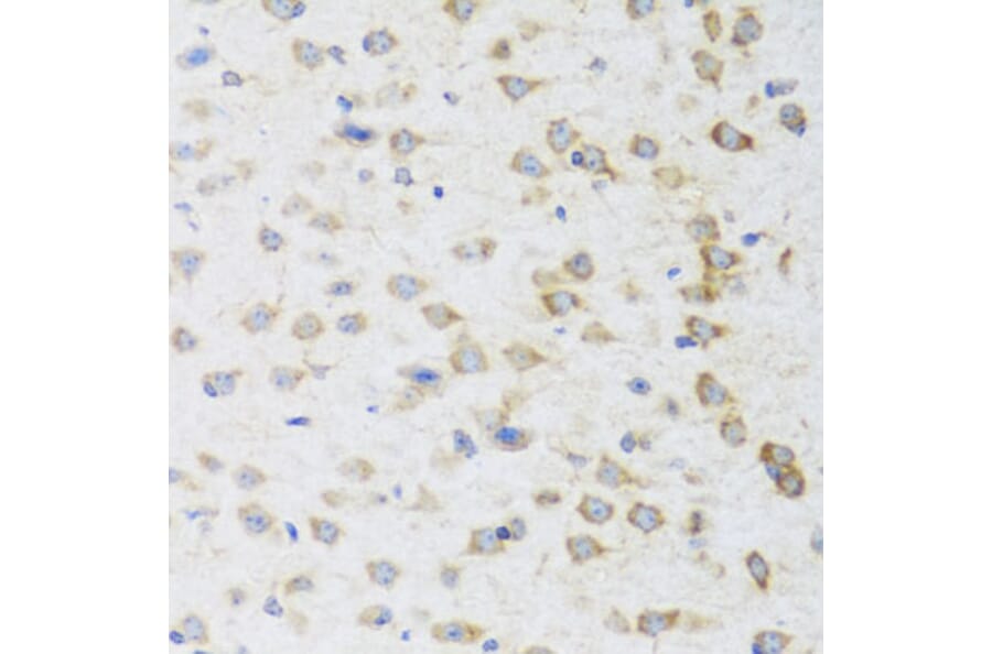 Immunohistochemistry - Anti-Striatin Antibody (A15861) - Antibodies.com