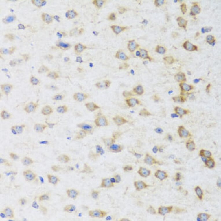 Immunohistochemistry - Anti-Striatin Antibody (A15861) - Antibodies.com