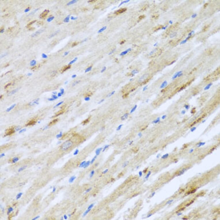 Immunohistochemistry - Anti-Striatin Antibody (A15861) - Antibodies.com