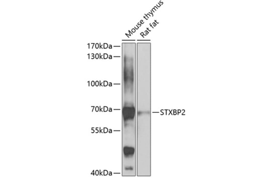 Western Blot - Anti-Munc18-2 Antibody (A15862) - Antibodies.com