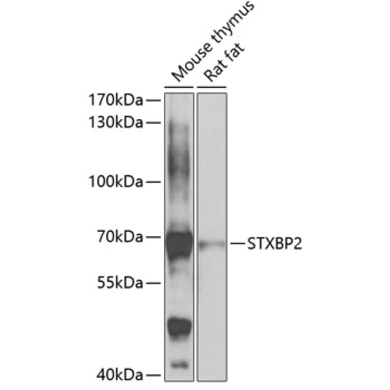 Western Blot - Anti-Munc18-2 Antibody (A15862) - Antibodies.com