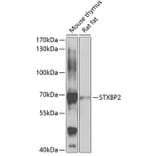Western Blot - Anti-Munc18-2 Antibody (A15862) - Antibodies.com