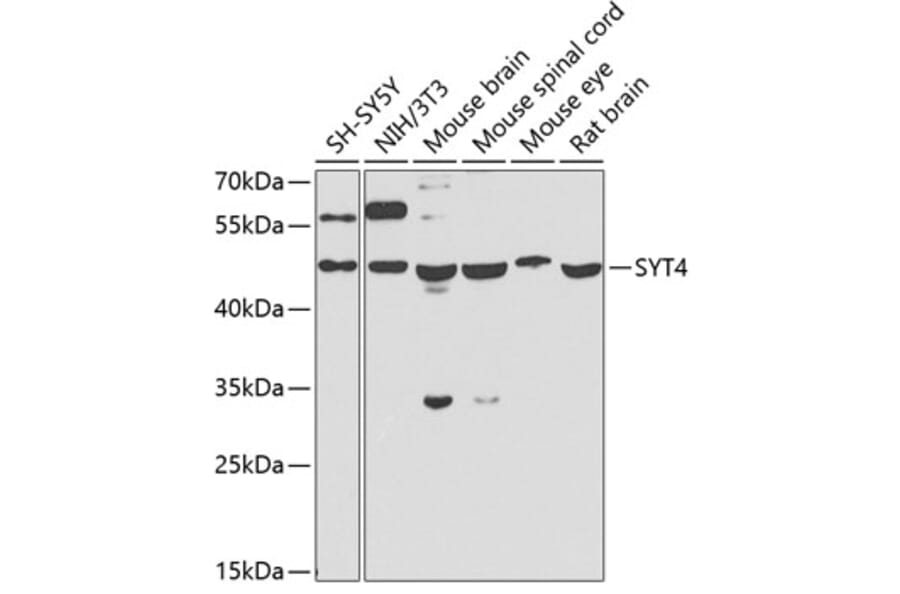 Western Blot - Anti-Synaptotagmin Antibody (A15863) - Antibodies.com