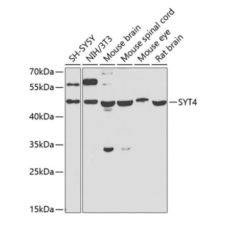 Western Blot - Anti-Synaptotagmin Antibody (A15863) - Antibodies.com