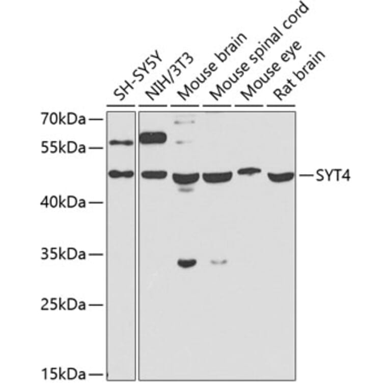 Western Blot - Anti-Synaptotagmin Antibody (A15863) - Antibodies.com