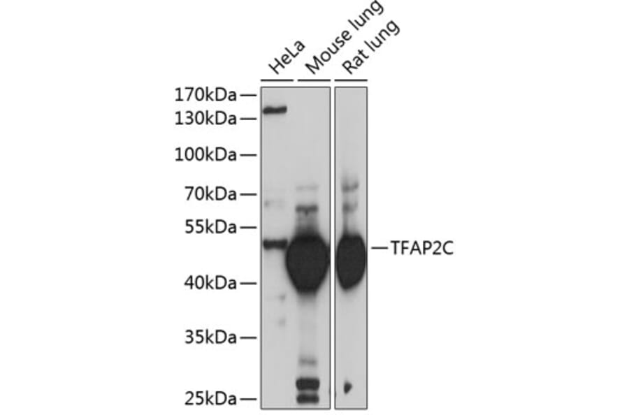 Western Blot - Anti-AP2 gamma/TFAP2C Antibody (A15864) - Antibodies.com