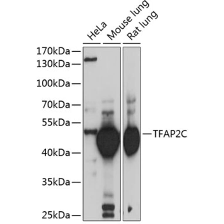 Western Blot - Anti-AP2 gamma/TFAP2C Antibody (A15864) - Antibodies.com