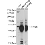 Western Blot - Anti-AP2 gamma/TFAP2C Antibody (A15864) - Antibodies.com