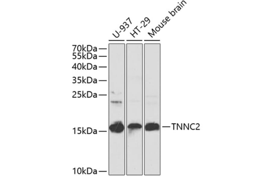 Western Blot - Anti-TNNC2 Antibody (A15865) - Antibodies.com